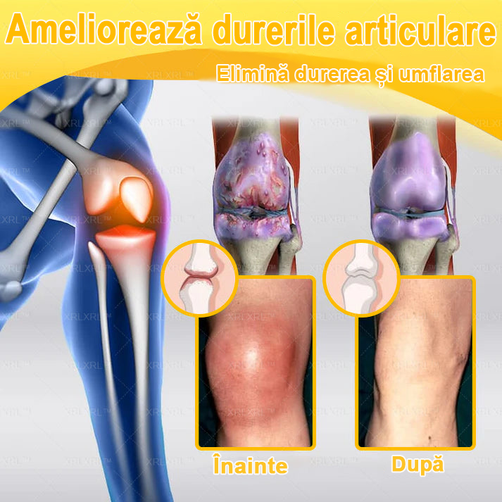 🌿 𝐗𝐑𝐋𝐗𝐑𝐋® 𝐂𝐫𝐞𝐦ă 𝐜𝐮 𝐕𝐄𝐍𝐈𝐍 𝐃𝐄 𝐀𝐋𝐁𝐈𝐍𝐄 𝐩𝐞𝐧𝐭𝐫𝐮 𝐀𝐦𝐞𝐥𝐢𝐨𝐫𝐚𝐫𝐞𝐚 𝐃𝐮𝐫𝐞𝐫𝐢𝐥𝐨𝐫 𝐀𝐫𝐭𝐢𝐜𝐮𝐥𝐚𝐫𝐞 ș𝐢 𝐒𝐮𝐬ț𝐢𝐧𝐞𝐫𝐞𝐚 𝐒ă𝐧ă𝐭ăț𝐢𝐢 𝐎𝐚𝐬𝐞𝐥𝐨𝐫 👨‍⚕️ (𝐒𝐩𝐞𝐜𝐢𝐚𝐥 𝐜𝐫𝐞𝐚𝐭ă 𝐩𝐞𝐧𝐭𝐫𝐮 𝐩𝐞𝐫𝐬𝐨𝐚𝐧𝐞𝐥𝐞 î𝐧 𝐯â𝐫𝐬𝐭ă)