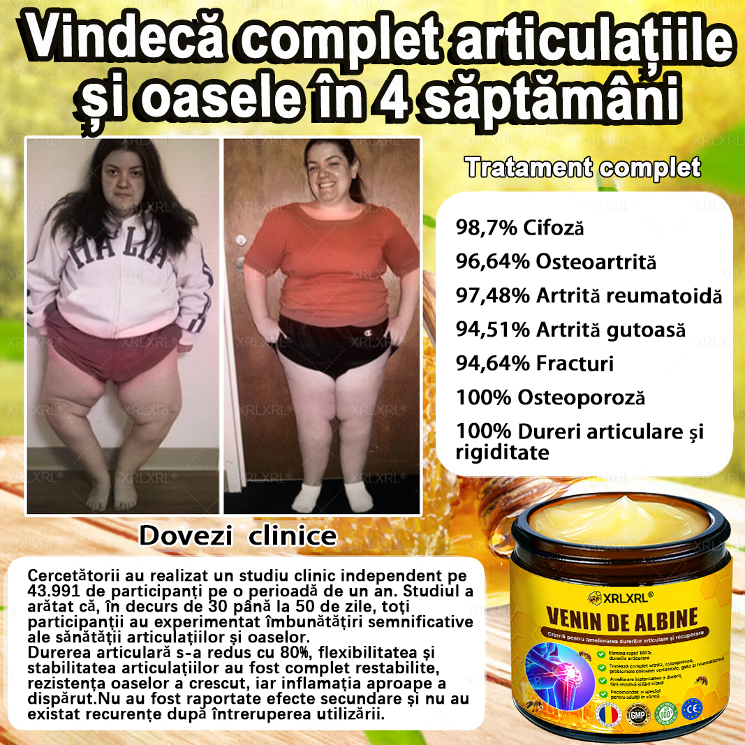 🌿 𝐗𝐑𝐋𝐗𝐑𝐋® 𝐂𝐫𝐞𝐦ă 𝐜𝐮 𝐕𝐄𝐍𝐈𝐍 𝐃𝐄 𝐀𝐋𝐁𝐈𝐍𝐄 𝐩𝐞𝐧𝐭𝐫𝐮 𝐀𝐦𝐞𝐥𝐢𝐨𝐫𝐚𝐫𝐞𝐚 𝐃𝐮𝐫𝐞𝐫𝐢𝐥𝐨𝐫 𝐀𝐫𝐭𝐢𝐜𝐮𝐥𝐚𝐫𝐞 ș𝐢 𝐒𝐮𝐬ț𝐢𝐧𝐞𝐫𝐞𝐚 𝐒ă𝐧ă𝐭ăț𝐢𝐢 𝐎𝐚𝐬𝐞𝐥𝐨𝐫 👨‍⚕️ (𝐒𝐩𝐞𝐜𝐢𝐚𝐥 𝐜𝐫𝐞𝐚𝐭ă 𝐩𝐞𝐧𝐭𝐫𝐮 𝐩𝐞𝐫𝐬𝐨𝐚𝐧𝐞𝐥𝐞 î𝐧 𝐯â𝐫𝐬𝐭ă)