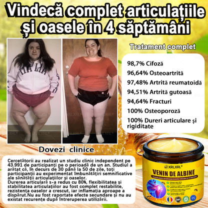 🌿 𝐗𝐑𝐋𝐗𝐑𝐋® 𝐂𝐫𝐞𝐦ă 𝐜𝐮 𝐕𝐄𝐍𝐈𝐍 𝐃𝐄 𝐀𝐋𝐁𝐈𝐍𝐄 𝐩𝐞𝐧𝐭𝐫𝐮 𝐀𝐦𝐞𝐥𝐢𝐨𝐫𝐚𝐫𝐞𝐚 𝐃𝐮𝐫𝐞𝐫𝐢𝐥𝐨𝐫 𝐀𝐫𝐭𝐢𝐜𝐮𝐥𝐚𝐫𝐞 ș𝐢 𝐒𝐮𝐬ț𝐢𝐧𝐞𝐫𝐞𝐚 𝐒ă𝐧ă𝐭ăț𝐢𝐢 𝐎𝐚𝐬𝐞𝐥𝐨𝐫 👨‍⚕️ (𝐒𝐩𝐞𝐜𝐢𝐚𝐥 𝐜𝐫𝐞𝐚𝐭ă 𝐩𝐞𝐧𝐭𝐫𝐮 𝐩𝐞𝐫𝐬𝐨𝐚𝐧𝐞𝐥𝐞 î𝐧 𝐯â𝐫𝐬𝐭ă)