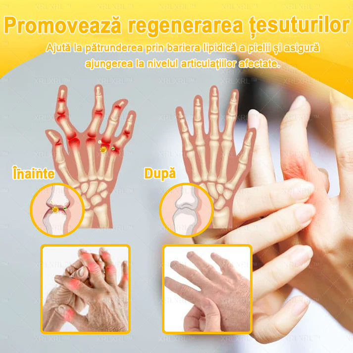 🌿 𝐗𝐑𝐋𝐗𝐑𝐋® 𝐂𝐫𝐞𝐦ă 𝐜𝐮 𝐕𝐄𝐍𝐈𝐍 𝐃𝐄 𝐀𝐋𝐁𝐈𝐍𝐄 𝐩𝐞𝐧𝐭𝐫𝐮 𝐀𝐦𝐞𝐥𝐢𝐨𝐫𝐚𝐫𝐞𝐚 𝐃𝐮𝐫𝐞𝐫𝐢𝐥𝐨𝐫 𝐀𝐫𝐭𝐢𝐜𝐮𝐥𝐚𝐫𝐞 ș𝐢 𝐒𝐮𝐬ț𝐢𝐧𝐞𝐫𝐞𝐚 𝐒ă𝐧ă𝐭ăț𝐢𝐢 𝐎𝐚𝐬𝐞𝐥𝐨𝐫 👨‍⚕️ (𝐒𝐩𝐞𝐜𝐢𝐚𝐥 𝐜𝐫𝐞𝐚𝐭ă 𝐩𝐞𝐧𝐭𝐫𝐮 𝐩𝐞𝐫𝐬𝐨𝐚𝐧𝐞𝐥𝐞 î𝐧 𝐯â𝐫𝐬𝐭ă)