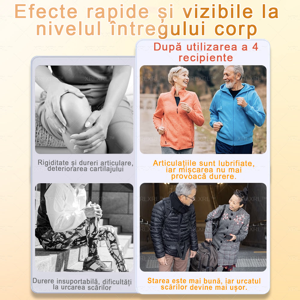 🌿 𝐗𝐑𝐋𝐗𝐑𝐋® 𝐂𝐫𝐞𝐦ă 𝐜𝐮 𝐕𝐄𝐍𝐈𝐍 𝐃𝐄 𝐀𝐋𝐁𝐈𝐍𝐄 𝐩𝐞𝐧𝐭𝐫𝐮 𝐀𝐦𝐞𝐥𝐢𝐨𝐫𝐚𝐫𝐞𝐚 𝐃𝐮𝐫𝐞𝐫𝐢𝐥𝐨𝐫 𝐀𝐫𝐭𝐢𝐜𝐮𝐥𝐚𝐫𝐞 ș𝐢 𝐒𝐮𝐬ț𝐢𝐧𝐞𝐫𝐞𝐚 𝐒ă𝐧ă𝐭ăț𝐢𝐢 𝐎𝐚𝐬𝐞𝐥𝐨𝐫 👨‍⚕️ (𝐒𝐩𝐞𝐜𝐢𝐚𝐥 𝐜𝐫𝐞𝐚𝐭ă 𝐩𝐞𝐧𝐭𝐫𝐮 𝐩𝐞𝐫𝐬𝐨𝐚𝐧𝐞𝐥𝐞 î𝐧 𝐯â𝐫𝐬𝐭ă)
