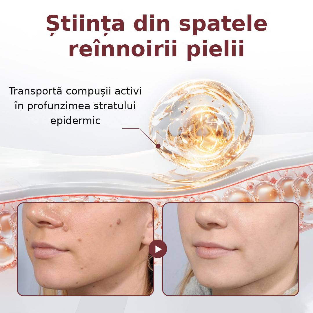 🌿👨‍⚕️Biancat® KeraErase Cremă cu Dublă Acțiune pentru Reînnoirea Pielii
