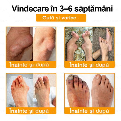 🌿 𝐗𝐑𝐋𝐗𝐑𝐋® 𝐂𝐫𝐞𝐦ă 𝐜𝐮 𝐕𝐄𝐍𝐈𝐍 𝐃𝐄 𝐀𝐋𝐁𝐈𝐍𝐄 𝐩𝐞𝐧𝐭𝐫𝐮 𝐀𝐦𝐞𝐥𝐢𝐨𝐫𝐚𝐫𝐞𝐚 𝐃𝐮𝐫𝐞𝐫𝐢𝐥𝐨𝐫 𝐀𝐫𝐭𝐢𝐜𝐮𝐥𝐚𝐫𝐞 ș𝐢 𝐒𝐮𝐬ț𝐢𝐧𝐞𝐫𝐞𝐚 𝐒ă𝐧ă𝐭ăț𝐢𝐢 𝐎𝐚𝐬𝐞𝐥𝐨𝐫 👨‍⚕️ (𝐒𝐩𝐞𝐜𝐢𝐚𝐥 𝐜𝐫𝐞𝐚𝐭ă 𝐩𝐞𝐧𝐭𝐫𝐮 𝐩𝐞𝐫𝐬𝐨𝐚𝐧𝐞𝐥𝐞 î𝐧 𝐯â𝐫𝐬𝐭ă)