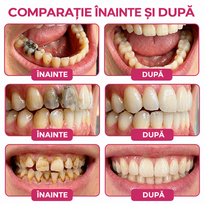 🌿🦷𝑹𝒐𝒍𝒊𝒎𝒆𝒚® 𝑫𝒆𝒏𝑷𝒆𝒓𝒎 𝑮𝒆𝒍 𝑵𝒂𝒕𝒖𝒓𝒂𝒍 𝒑𝒆𝒏𝒕𝒓𝒖 𝑹𝒆𝒑𝒂𝒓𝒂𝒓𝒆𝒂 𝑪𝒂𝒓𝒊𝒊𝒍𝒐𝒓 ș𝒊 𝑹𝒆𝒇𝒂𝒄𝒆𝒓𝒆𝒂 𝑺𝒎𝒂𝒍ț𝒖𝒍𝒖𝒊