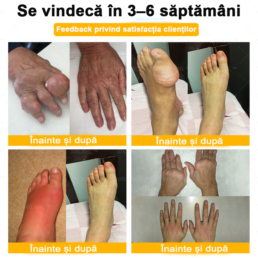 🌿 𝐗𝐑𝐋𝐗𝐑𝐋® 𝐂𝐫𝐞𝐦ă 𝐜𝐮 𝐕𝐄𝐍𝐈𝐍 𝐃𝐄 𝐀𝐋𝐁𝐈𝐍𝐄 𝐩𝐞𝐧𝐭𝐫𝐮 𝐀𝐦𝐞𝐥𝐢𝐨𝐫𝐚𝐫𝐞𝐚 𝐃𝐮𝐫𝐞𝐫𝐢𝐥𝐨𝐫 𝐀𝐫𝐭𝐢𝐜𝐮𝐥𝐚𝐫𝐞 ș𝐢 𝐒𝐮𝐬ț𝐢𝐧𝐞𝐫𝐞𝐚 𝐒ă𝐧ă𝐭ăț𝐢𝐢 𝐎𝐚𝐬𝐞𝐥𝐨𝐫 👨‍⚕️ (𝐒𝐩𝐞𝐜𝐢𝐚𝐥 𝐜𝐫𝐞𝐚𝐭ă 𝐩𝐞𝐧𝐭𝐫𝐮 𝐩𝐞𝐫𝐬𝐨𝐚𝐧𝐞𝐥𝐞 î𝐧 𝐯â𝐫𝐬𝐭ă)