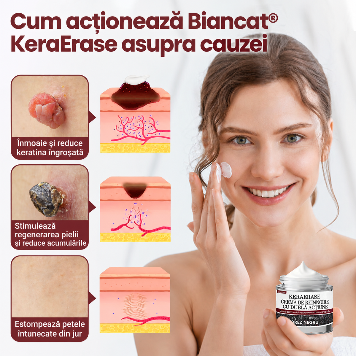 🌿👨‍⚕️Biancat® KeraErase Cremă cu Dublă Acțiune pentru Reînnoirea Pielii