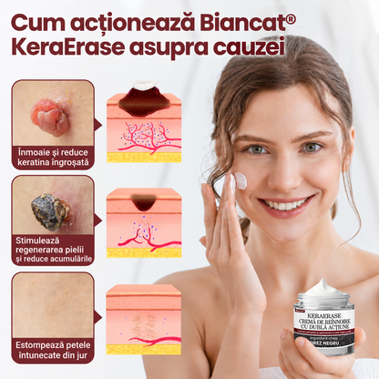 🌿👨‍⚕️Biancat® KeraErase Cremă cu Dublă Acțiune pentru Reînnoirea Pielii