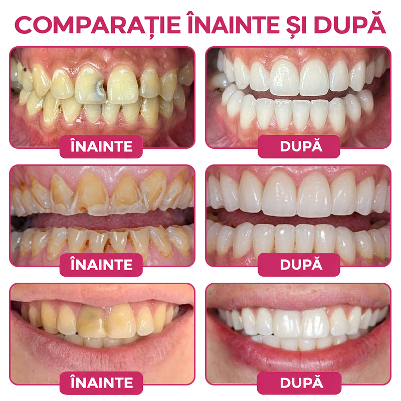 🌿🦷𝑹𝒐𝒍𝒊𝒎𝒆𝒚® 𝑫𝒆𝒏𝑷𝒆𝒓𝒎 𝑮𝒆𝒍 𝑵𝒂𝒕𝒖𝒓𝒂𝒍 𝒑𝒆𝒏𝒕𝒓𝒖 𝑹𝒆𝒑𝒂𝒓𝒂𝒓𝒆𝒂 𝑪𝒂𝒓𝒊𝒊𝒍𝒐𝒓 ș𝒊 𝑹𝒆𝒇𝒂𝒄𝒆𝒓𝒆𝒂 𝑺𝒎𝒂𝒍ț𝒖𝒍𝒖𝒊