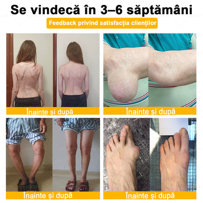 🌿 𝐗𝐑𝐋𝐗𝐑𝐋® 𝐂𝐫𝐞𝐦ă 𝐜𝐮 𝐕𝐄𝐍𝐈𝐍 𝐃𝐄 𝐀𝐋𝐁𝐈𝐍𝐄 𝐩𝐞𝐧𝐭𝐫𝐮 𝐀𝐦𝐞𝐥𝐢𝐨𝐫𝐚𝐫𝐞𝐚 𝐃𝐮𝐫𝐞𝐫𝐢𝐥𝐨𝐫 𝐀𝐫𝐭𝐢𝐜𝐮𝐥𝐚𝐫𝐞 ș𝐢 𝐒𝐮𝐬ț𝐢𝐧𝐞𝐫𝐞𝐚 𝐒ă𝐧ă𝐭ăț𝐢𝐢 𝐎𝐚𝐬𝐞𝐥𝐨𝐫 👨‍⚕️ (𝐒𝐩𝐞𝐜𝐢𝐚𝐥 𝐜𝐫𝐞𝐚𝐭ă 𝐩𝐞𝐧𝐭𝐫𝐮 𝐩𝐞𝐫𝐬𝐨𝐚𝐧𝐞𝐥𝐞 î𝐧 𝐯â𝐫𝐬𝐭ă)