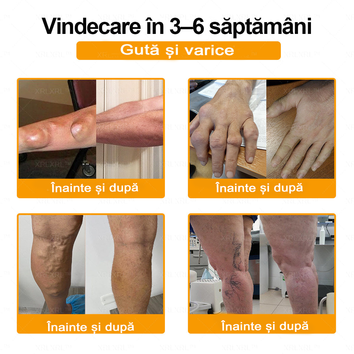 🌿 𝐗𝐑𝐋𝐗𝐑𝐋® 𝐂𝐫𝐞𝐦ă 𝐜𝐮 𝐕𝐄𝐍𝐈𝐍 𝐃𝐄 𝐀𝐋𝐁𝐈𝐍𝐄 𝐩𝐞𝐧𝐭𝐫𝐮 𝐀𝐦𝐞𝐥𝐢𝐨𝐫𝐚𝐫𝐞𝐚 𝐃𝐮𝐫𝐞𝐫𝐢𝐥𝐨𝐫 𝐀𝐫𝐭𝐢𝐜𝐮𝐥𝐚𝐫𝐞 ș𝐢 𝐒𝐮𝐬ț𝐢𝐧𝐞𝐫𝐞𝐚 𝐒ă𝐧ă𝐭ăț𝐢𝐢 𝐎𝐚𝐬𝐞𝐥𝐨𝐫 👨‍⚕️ (𝐒𝐩𝐞𝐜𝐢𝐚𝐥 𝐜𝐫𝐞𝐚𝐭ă 𝐩𝐞𝐧𝐭𝐫𝐮 𝐩𝐞𝐫𝐬𝐨𝐚𝐧𝐞𝐥𝐞 î𝐧 𝐯â𝐫𝐬𝐭ă)