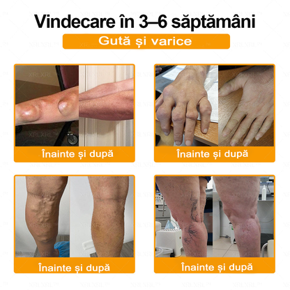 🌿 𝐗𝐑𝐋𝐗𝐑𝐋® 𝐂𝐫𝐞𝐦ă 𝐜𝐮 𝐕𝐄𝐍𝐈𝐍 𝐃𝐄 𝐀𝐋𝐁𝐈𝐍𝐄 𝐩𝐞𝐧𝐭𝐫𝐮 𝐀𝐦𝐞𝐥𝐢𝐨𝐫𝐚𝐫𝐞𝐚 𝐃𝐮𝐫𝐞𝐫𝐢𝐥𝐨𝐫 𝐀𝐫𝐭𝐢𝐜𝐮𝐥𝐚𝐫𝐞 ș𝐢 𝐒𝐮𝐬ț𝐢𝐧𝐞𝐫𝐞𝐚 𝐒ă𝐧ă𝐭ăț𝐢𝐢 𝐎𝐚𝐬𝐞𝐥𝐨𝐫 👨‍⚕️ (𝐒𝐩𝐞𝐜𝐢𝐚𝐥 𝐜𝐫𝐞𝐚𝐭ă 𝐩𝐞𝐧𝐭𝐫𝐮 𝐩𝐞𝐫𝐬𝐨𝐚𝐧𝐞𝐥𝐞 î𝐧 𝐯â𝐫𝐬𝐭ă)